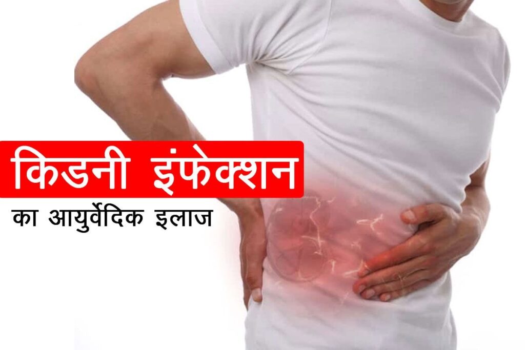 Kidney-infection-ayurvedic-treatment