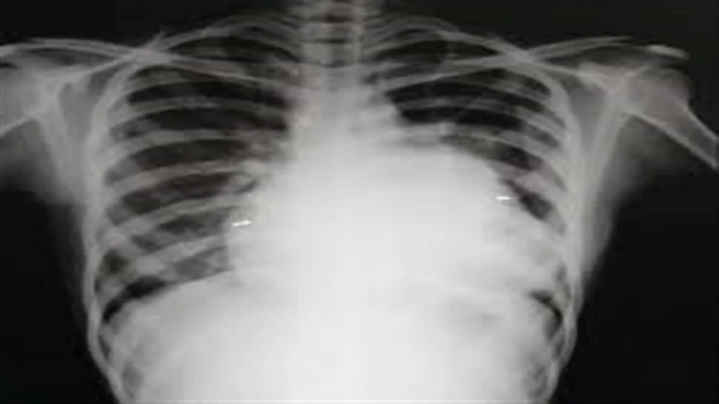 ਅੰਮ੍ਰਿਤਸਰ