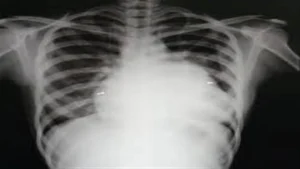 ਅੰਮ੍ਰਿਤਸਰ